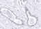 Abraxas 1, BRCA1 A Complex Subunit antibody, NBP1-76827, Novus Biologicals, Immunohistochemistry paraffin image 