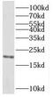 Protein TB2 antibody, FNab07231, FineTest, Western Blot image 