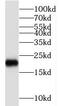 Nucleoside-Triphosphatase, Cancer-Related antibody, FNab01068, FineTest, Western Blot image 