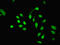 PHD Finger Protein 10 antibody, LS-C376308, Lifespan Biosciences, Immunofluorescence image 