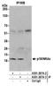 Cyclin-dependent kinase inhibitor 2A, isoforms 1/2/3 antibody, A301-267A, Bethyl Labs, Immunoprecipitation image 