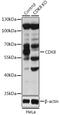 Cyclin Dependent Kinase 8 antibody, GTX33086, GeneTex, Western Blot image 