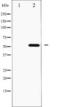 Ribosomal Protein S6 Kinase B2 antibody, TA325831, Origene, Western Blot image 
