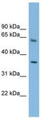 Peroxisomal Biogenesis Factor 26 antibody, TA344949, Origene, Western Blot image 
