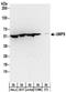 Uridine Monophosphate Synthetase antibody, NBP2-32172, Novus Biologicals, Western Blot image 