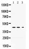 Serpin Family I Member 1 antibody, PB9744, Boster Biological Technology, Western Blot image 