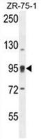 ArfGAP With Coiled-Coil, Ankyrin Repeat And PH Domains 1 antibody, AP50038PU-N, Origene, Western Blot image 