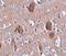 Cell Death Inducing P53 Target 1 antibody, NBP1-76996, Novus Biologicals, Immunohistochemistry paraffin image 