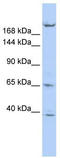 Kinesin Family Member 13B antibody, TA334698, Origene, Western Blot image 