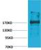 Ectopic P-Granules Autophagy Protein 5 Homolog antibody, A07711, Boster Biological Technology, Western Blot image 