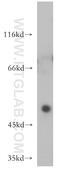 Homeobox C10 antibody, 12025-1-AP, Proteintech Group, Western Blot image 