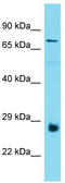 Proline And Serine Rich 3 antibody, TA339977, Origene, Western Blot image 