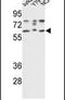 Acetylcholinesterase antibody, PA5-15010, Invitrogen Antibodies, Western Blot image 