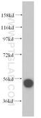 Ribosomal RNA processing protein 1 homolog A antibody, 14896-1-AP, Proteintech Group, Western Blot image 