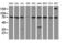 SPG7 Matrix AAA Peptidase Subunit, Paraplegin antibody, M04104-1, Boster Biological Technology, Western Blot image 