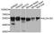 Aldehyde Dehydrogenase 1 Family Member B1 antibody, orb373147, Biorbyt, Western Blot image 