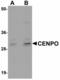 Centromere protein O antibody, LS-C108602, Lifespan Biosciences, Western Blot image 