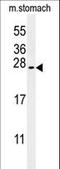 SERTA Domain Containing 3 antibody, LS-C161512, Lifespan Biosciences, Western Blot image 