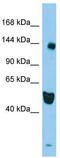 RAS Protein Activator Like 2 antibody, TA334361, Origene, Western Blot image 