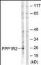 Protein phosphatase inhibitor 2 antibody, orb96027, Biorbyt, Western Blot image 