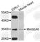 MAGE Family Member A6 antibody, A8130, ABclonal Technology, Western Blot image 