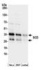 Scd antibody, A305-259A, Bethyl Labs, Western Blot image 