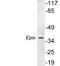 Erythropoietin antibody, LS-C199849, Lifespan Biosciences, Western Blot image 
