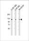 SH3 And PX Domains 2B antibody, M08324, Boster Biological Technology, Western Blot image 