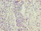 Family With Sequence Similarity 222 Member B antibody, LS-C397751, Lifespan Biosciences, Immunohistochemistry paraffin image 