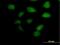Zinc finger and BTB domain-containing protein 32 antibody, H00027033-B02P, Novus Biologicals, Immunofluorescence image 