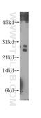 Homologous-pairing protein 2 homolog antibody, 11339-1-AP, Proteintech Group, Western Blot image 