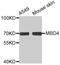 Methyl-CpG Binding Domain 4, DNA Glycosylase antibody, MBS126775, MyBioSource, Western Blot image 