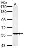 Dimethylaniline monooxygenase [N-oxide-forming] 3 antibody, GTX113698, GeneTex, Western Blot image 