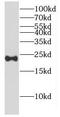 Complexin 2 antibody, FNab01921, FineTest, Western Blot image 