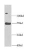 Acetylserotonin O-Methyltransferase Like antibody, FNab00642, FineTest, Western Blot image 