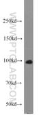 Protein unc-45 homolog A antibody, 15479-1-AP, Proteintech Group, Western Blot image 