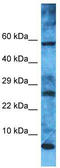 Mitochondrial Ribosomal Protein L52 antibody, TA337438, Origene, Western Blot image 