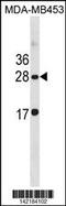 Claudin 14 antibody, 60-829, ProSci, Western Blot image 