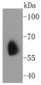Potassium voltage-gated channel subfamily A member 1 antibody, A01813-2, Boster Biological Technology, Western Blot image 