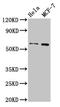 Matrix Metallopeptidase 28 antibody, LS-C672716, Lifespan Biosciences, Western Blot image 