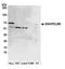 PDZ and LIM domain protein 5 antibody, A301-704A, Bethyl Labs, Western Blot image 