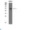 Immunoglobulin Heavy Constant Mu antibody, LS-C813539, Lifespan Biosciences, Western Blot image 