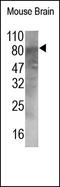 Activin A Receptor Type 2A antibody, 251303, Abbiotec, Immunohistochemistry paraffin image 