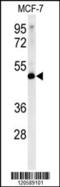 Lymphocyte-specific protein 1 antibody, 61-932, ProSci, Western Blot image 