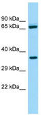 Aldehyde dehydrogenase family 16 member A1 antibody, TA334397, Origene, Western Blot image 