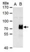 AT-Rich Interaction Domain 5A antibody, PA5-32020, Invitrogen Antibodies, Western Blot image 