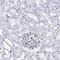 DEF6 Guanine Nucleotide Exchange Factor antibody, PA5-58619, Invitrogen Antibodies, Immunohistochemistry frozen image 
