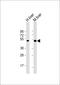 Chitobiase antibody, M07145, Boster Biological Technology, Western Blot image 