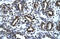 Transforming Growth Factor Beta 1 Induced Transcript 1 antibody, ARP33442_P050, Aviva Systems Biology, Immunohistochemistry paraffin image 