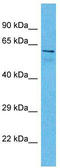 A-Kinase Anchoring Protein 8 Like antibody, TA329433, Origene, Western Blot image 